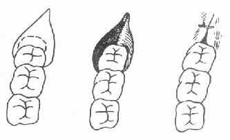 ������ĥ����������Ш���г���