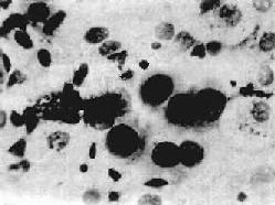 ̵ͿƬ�еķ���<a href=