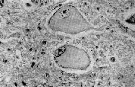 ����NisslС���ܽ�