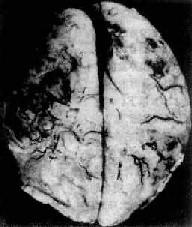 ��ŧ����Ĥ��